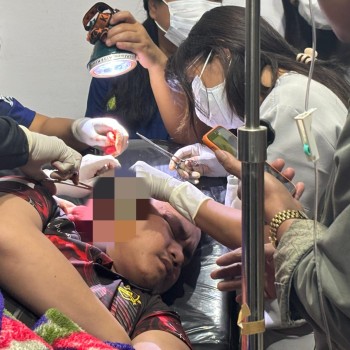 Personel Polres Intan Jaya Alami Luka Akibat Dianiaya OTK, Diduga Bagian dari KKB